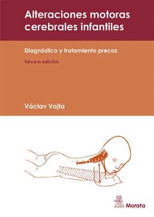 ALTERACIONES MOTORAS CEREBRALES INFANTILES